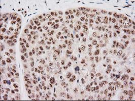 m04317 anti monoacylglycerol lipase mgll mouse monoclonal antibody clone id oti1h1 ihc testing 13