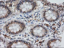 m04317 anti monoacylglycerol lipase mgll mouse monoclonal antibody clone id oti1h1 ihc testing 14