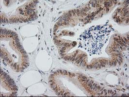 m04317 anti monoacylglycerol lipase mgll mouse monoclonal antibody clone id oti1h1 ihc testing 15