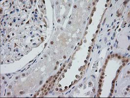 m04317 anti monoacylglycerol lipase mgll mouse monoclonal antibody clone id oti1h1 ihc testing 16