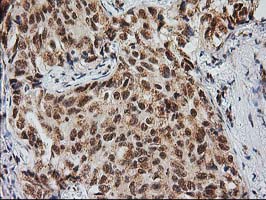 m04317 anti monoacylglycerol lipase mgll mouse monoclonal antibody clone id oti1h1 ihc testing 2