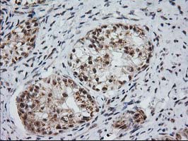 m04317 anti monoacylglycerol lipase mgll mouse monoclonal antibody clone id oti1h1 ihc testing 3
