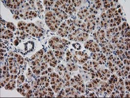m04317 anti monoacylglycerol lipase mgll mouse monoclonal antibody clone id oti1h1 ihc testing 4