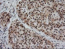 m04317 anti monoacylglycerol lipase mgll mouse monoclonal antibody clone id oti1h1 ihc testing 5