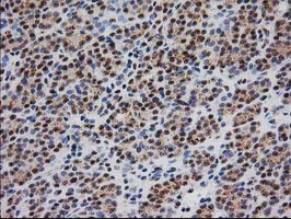 m04317 anti monoacylglycerol lipase mgll mouse monoclonal antibody clone id oti1h1 ihc testing 6