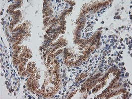 m04317 anti monoacylglycerol lipase mgll mouse monoclonal antibody clone id oti1h1 ihc testing 7
