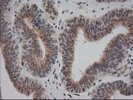 m04317 anti monoacylglycerol lipase mgll mouse monoclonal antibody clone id oti1h1 ihc testing 8