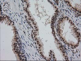 m04317 anti monoacylglycerol lipase mgll mouse monoclonal antibody clone id oti1h1 ihc testing 9
