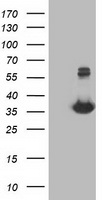 m04317 anti monoacylglycerol lipase mgll mouse monoclonal antibody clone id oti1h1 wb testing 1