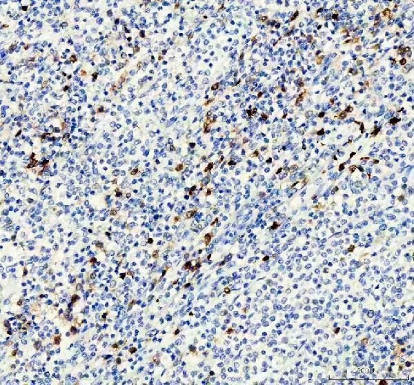 IHC analysis of TYMS using anti-TYMS antibody (M04320-1)