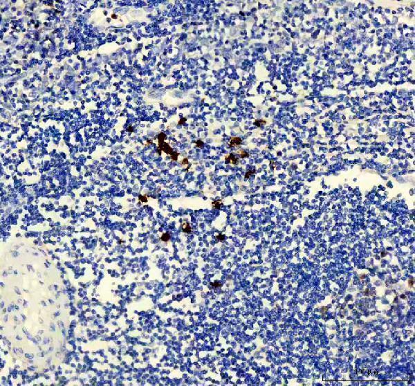 IHC analysis of TYMS using anti-TYMS antibody (M04320-1)