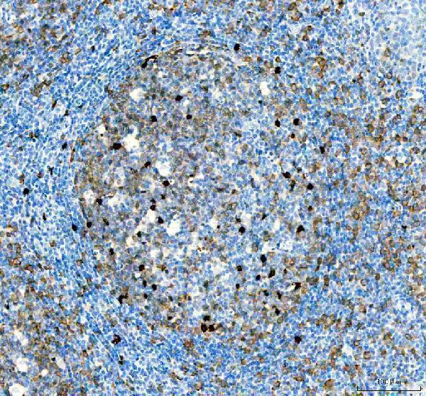 m04320 1 tyms primary antibodies ihc testing 4