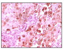 Immunohistochemistry validation of CACYBP using Anti-Calcyclin CACYBP Monoclonal Antibody (M04327)