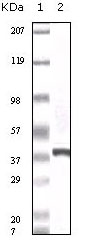 Western blotting validation for Anti-Calcyclin CACYBP Monoclonal Antibody M04327
Western Blot (WB) analysis using Calcyclin Monoclonal Antibody against truncated calcyclin recombinant protein