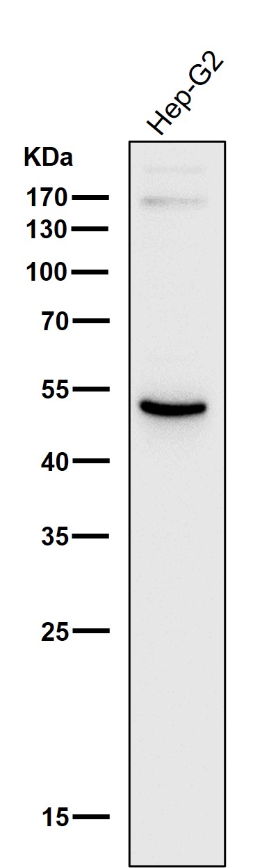 All lanes use the Antibody at 1:1K dilution for 1 hour at room temperature