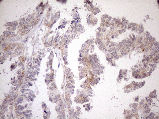 m04333 anti ciapin1 mouse monoclonal antibody clone id oti5a6 ihc testing 2