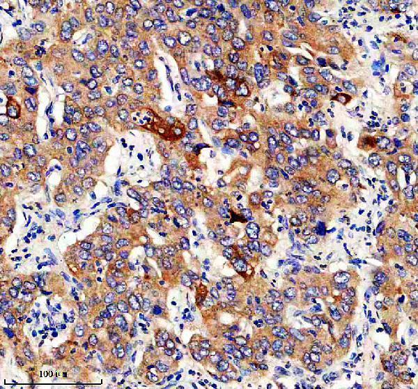 m04341 gfpt1 primary antibodies ihc testing 1