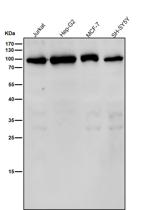 All lanes use the Antibody at 1:1K dilution for 1 hour at room temperature