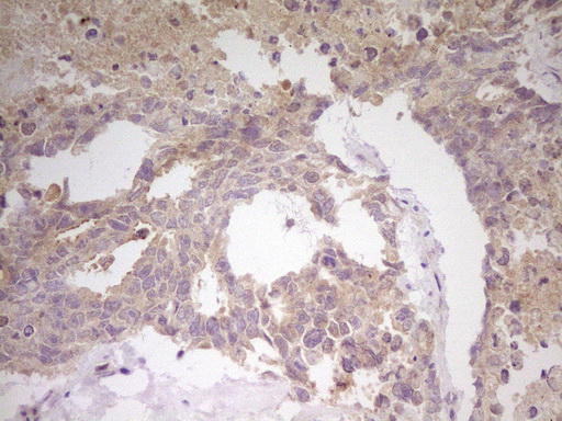 m04351 anti cited1 mouse monoclonal antibody clone id oti3c12 ihc testing 3