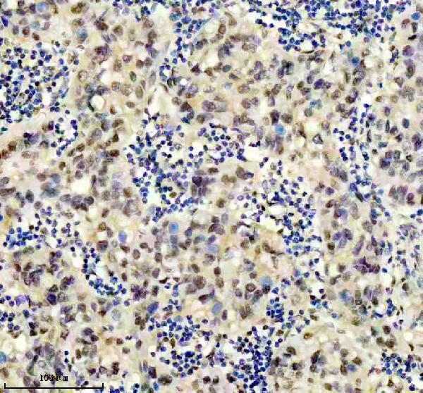 IHC analysis of PSMA3 using anti-PSMA3 antibody (M04355)