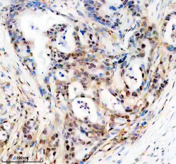 m04355 psma3 primary antibodies ihc testing 3
