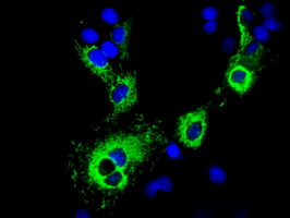 m04360 1 anti cisd1 mouse monoclonal antibody clone id oti3a1 if testing 4