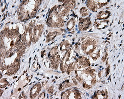m04360 1 anti cisd1 mouse monoclonal antibody clone id oti3a1 ihc testing 2
