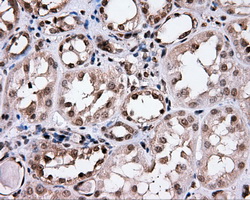 m04360 1 anti cisd1 mouse monoclonal antibody clone id oti3a1 ihc testing 3