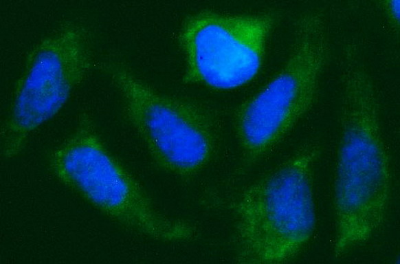 m04360 anti cisd1 mouse monoclonal antibody clone id oti2b3 if testing 5