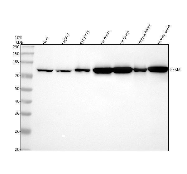  Western blot analysis of PFKM using anti-PFKM antibody (M04370-1)