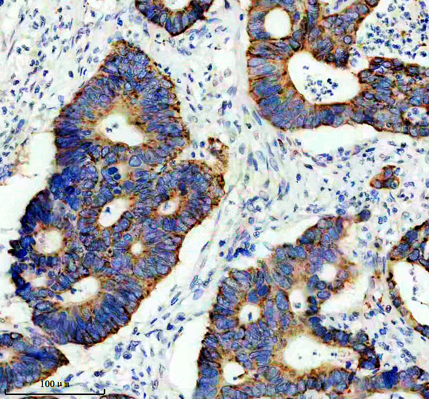 IHC analysis of HMGCS2 using anti-HMGCS2 antibody (M04371)