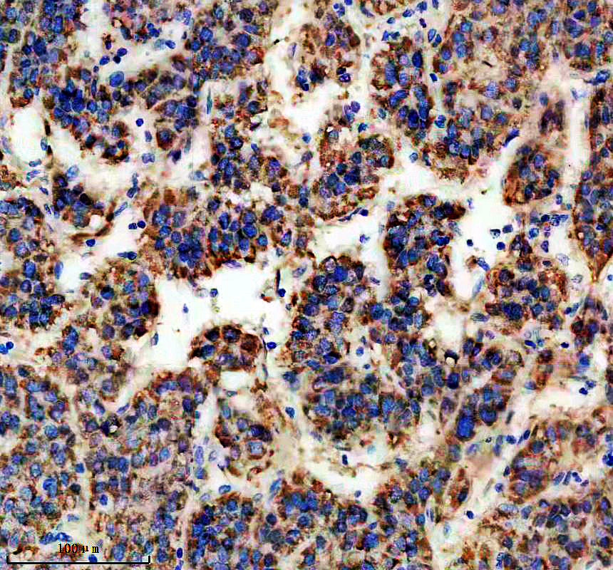 IHC analysis of HMGCS2 using anti-HMGCS2 antibody (M04371)