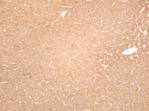 Mouse liver was stained with anti-ACSL4 rabbit antibody