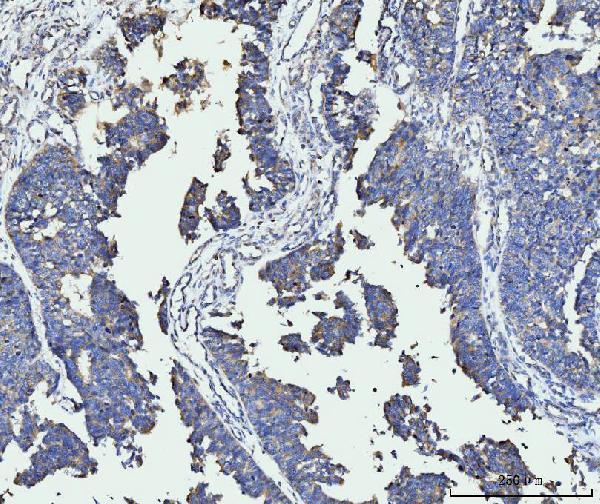  IHC analysis of FACL4/ACSL4 using anti-FACL4/ACSL4 antibody (M04372)