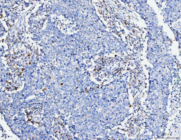  IHC analysis of FACL4/ACSL4 using anti-FACL4/ACSL4 antibody (M04372)