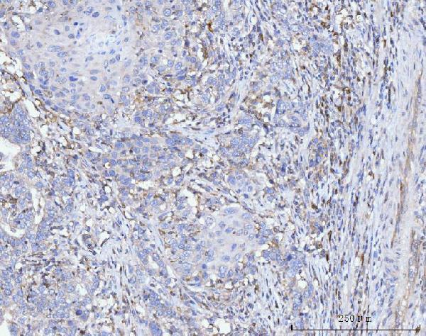 m04372 acsl4 primary antibodies ihc testing 4