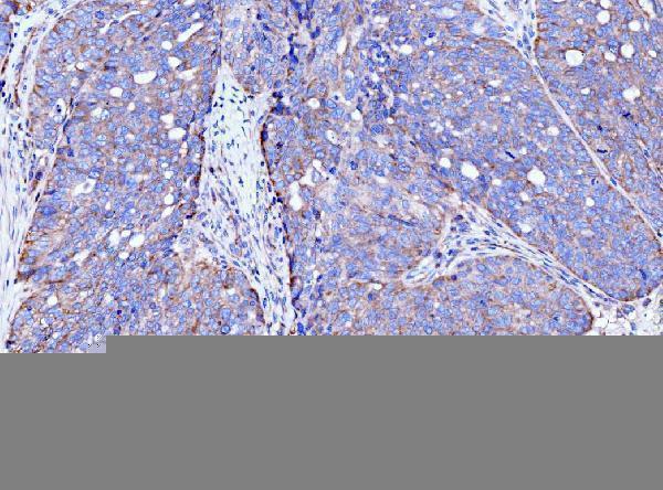 m04372 acsl4 primary antibodies ihc testing 5