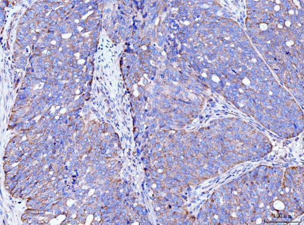 m04372 acsl4 primary antibodies ihc testing 5_1