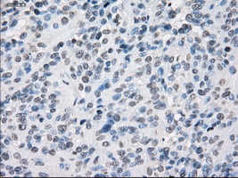 m04381 1 anti lat2 slc7a8 mouse monoclonal antibody clone id oti7d6 ihc testing 10