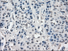 m04381 1 anti lat2 slc7a8 mouse monoclonal antibody clone id oti7d6 ihc testing 11