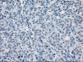 m04381 1 anti lat2 slc7a8 mouse monoclonal antibody clone id oti7d6 ihc testing 8