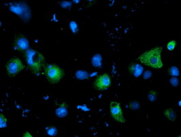 m04381 2 anti lat2 slc7a8 mouse monoclonal antibody clone id oti4a6 if testing 4