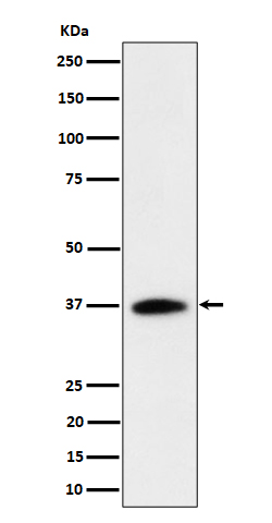 Western blot analysis of RASSF2 expression in Jurkat cell lysate