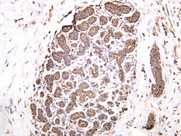 Human breast was stained with anti-eIF2α rabbit antibody