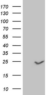 HEK293T cells were transfected with the pCMV6-ENTRY control (Left lane) or pCMV6-ENTRY CLDN3 (Right lane) cDNA for 48 hrs and lysed