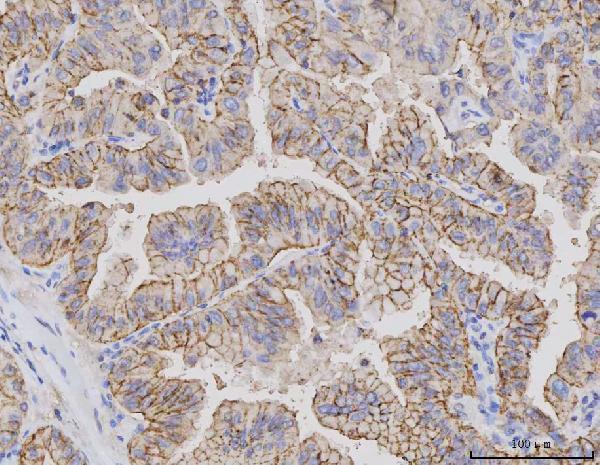 m04393 2 cldn3 primary antibodies ihc testing 4