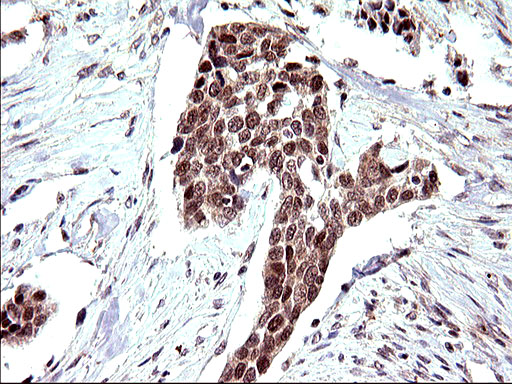m04394 anti necdin ndn mouse monoclonal antibody clone id oti5d1 ihc testing 11