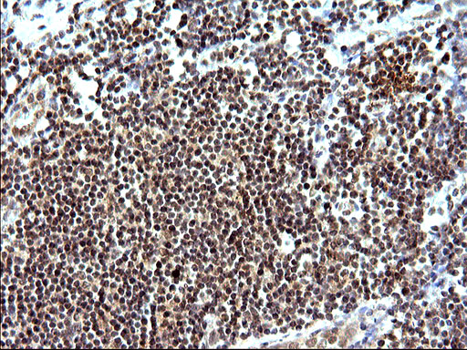 m04394 anti necdin ndn mouse monoclonal antibody clone id oti5d1 ihc testing 12