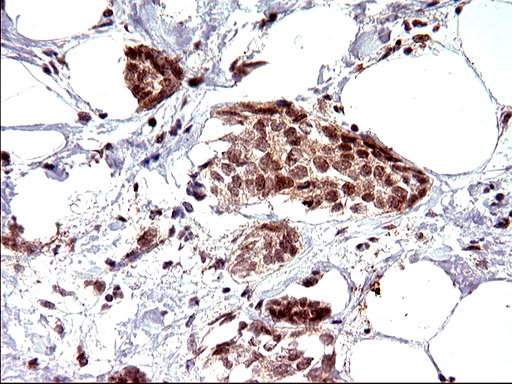 m04394 anti necdin ndn mouse monoclonal antibody clone id oti5d1 ihc testing 14