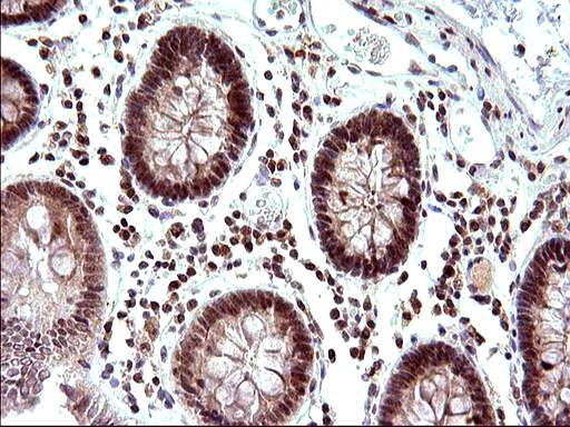 m04394 anti necdin ndn mouse monoclonal antibody clone id oti5d1 ihc testing 15